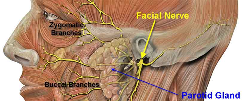 facial-nerve-palsy