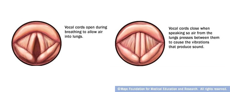 vocal-cord-paralysis
