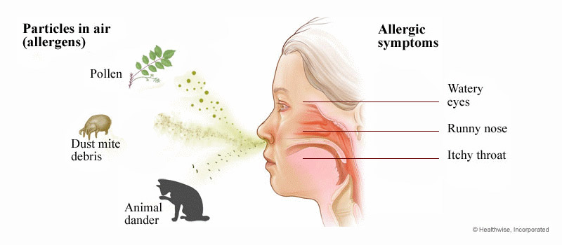 Nose deals allergy symptoms