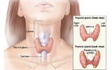 parathyroid-thumb