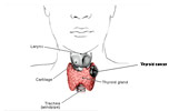 thyroid-cancer