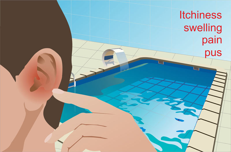 otitis-externa-swimmers-ear-infection
